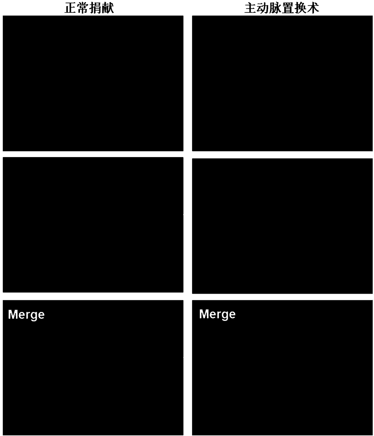 Separation, screening, culture and functional identification method of human aortic vascular wall stem cells expressing c-Kit