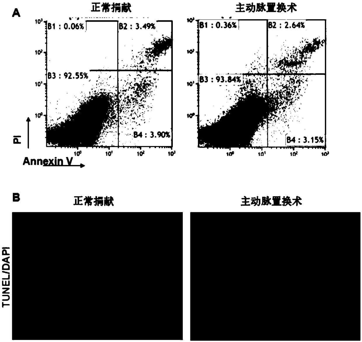 Separation, screening, culture and functional identification method of human aortic vascular wall stem cells expressing c-Kit