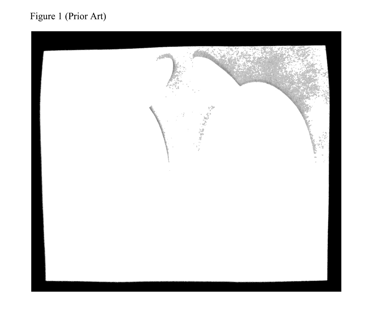 Patient Eye Protection Device For Dermatology, X-Ray, and General Anesthesia Procedures