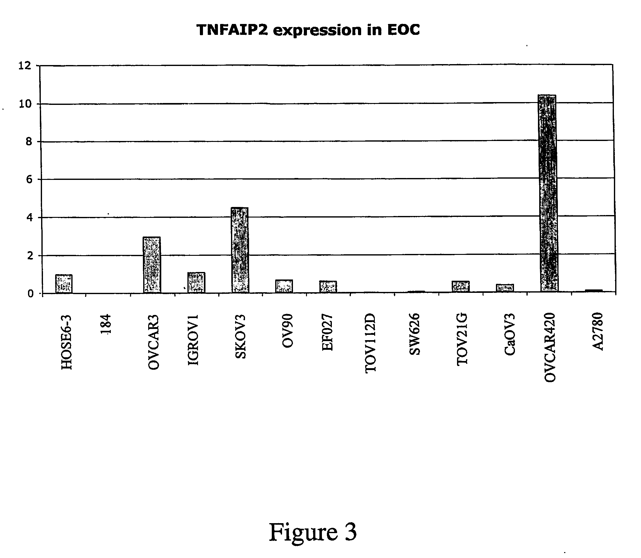 Methods of diagnosis and prognosis of ovarian cancer II