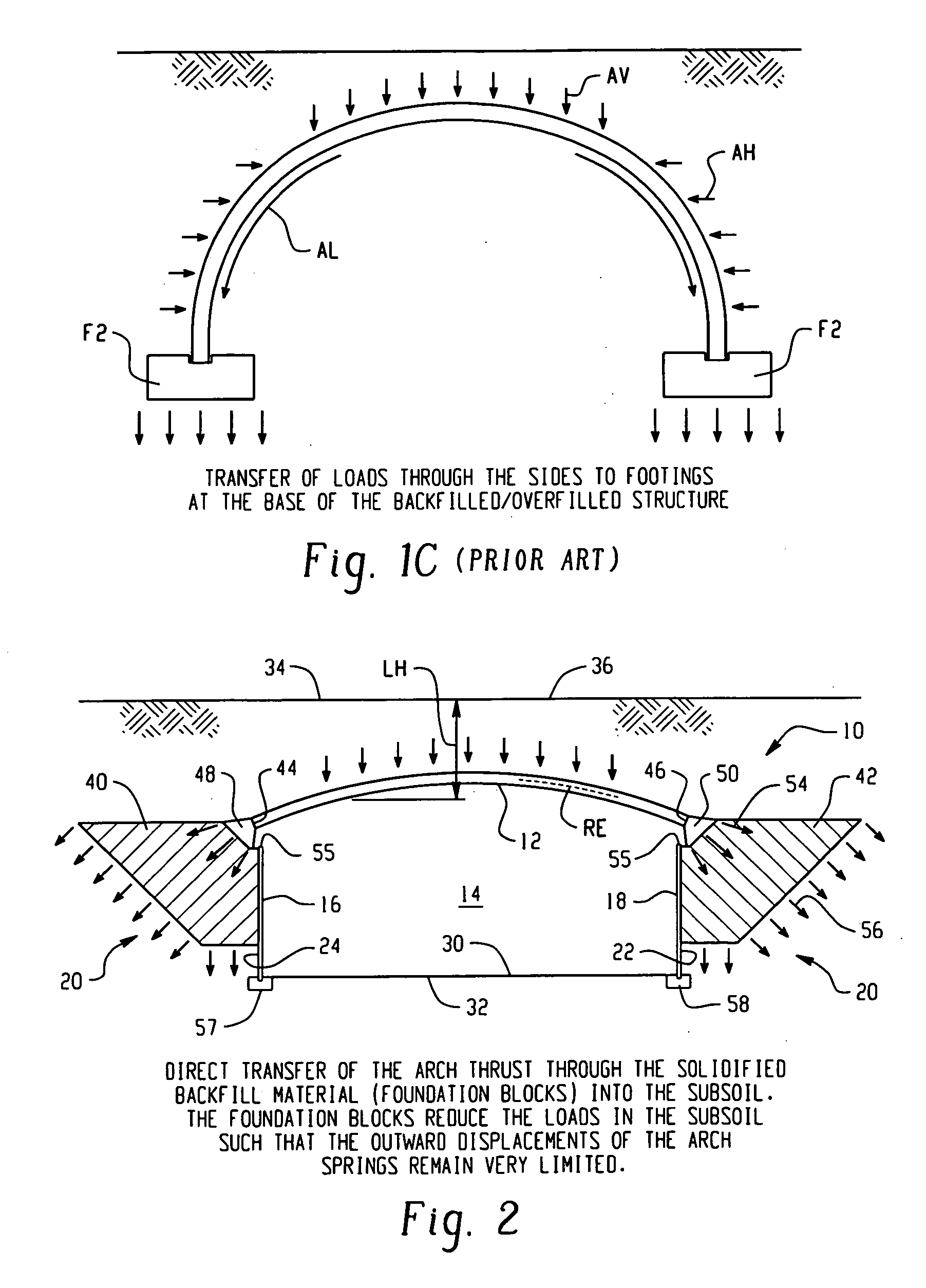 Top arch overfilled system