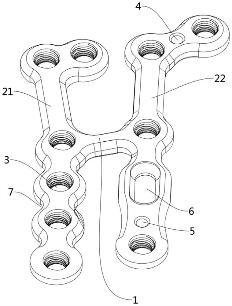 Wrist locking plate and osteosynthesis device