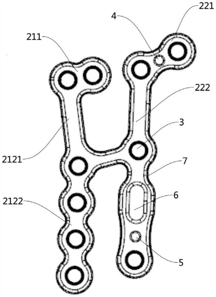 Wrist locking plate and osteosynthesis device