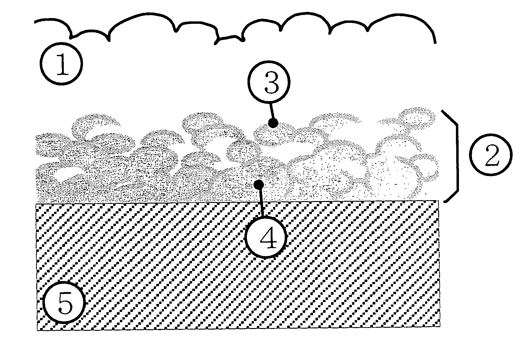 Orthopedic and dental endosseous implants and their preparation method