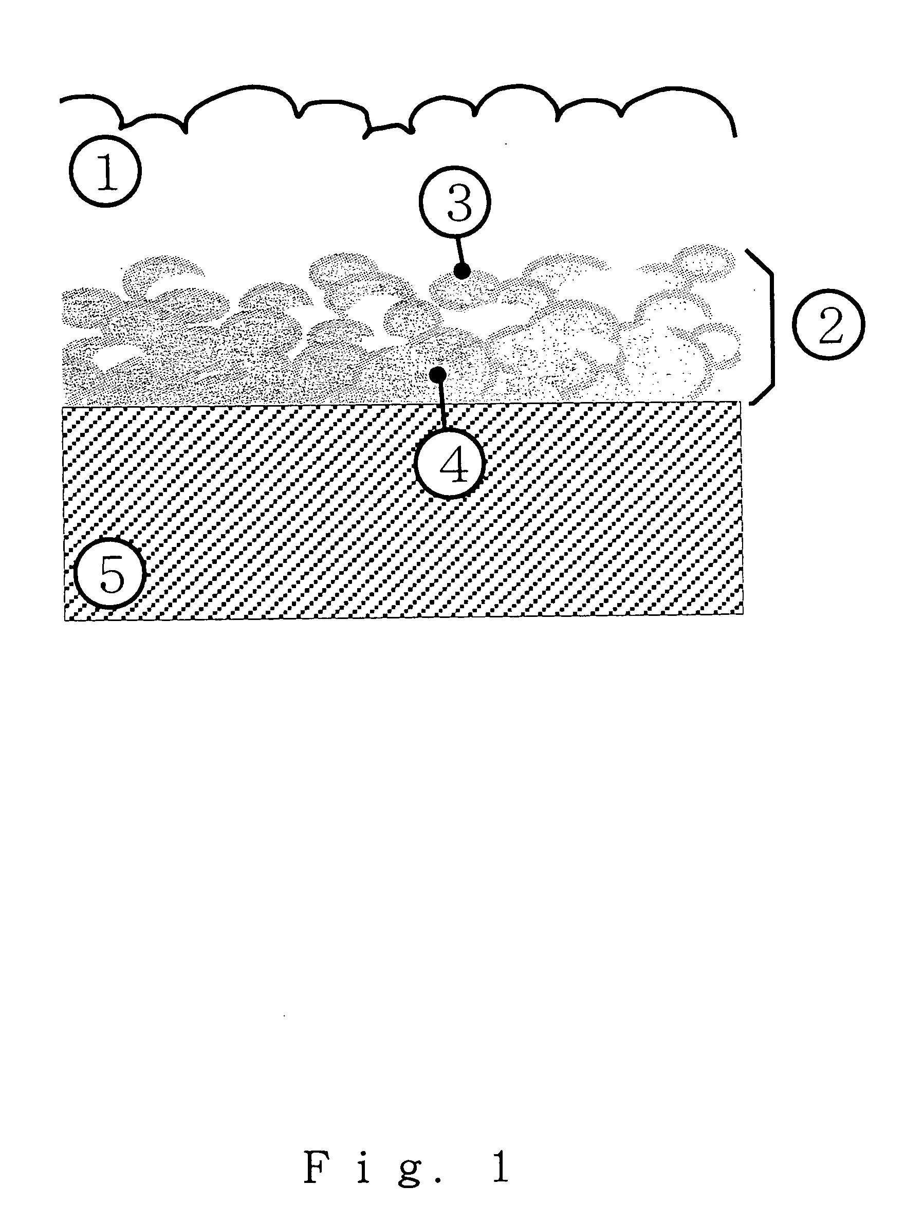 Orthopedic and dental endosseous implants and their preparation method