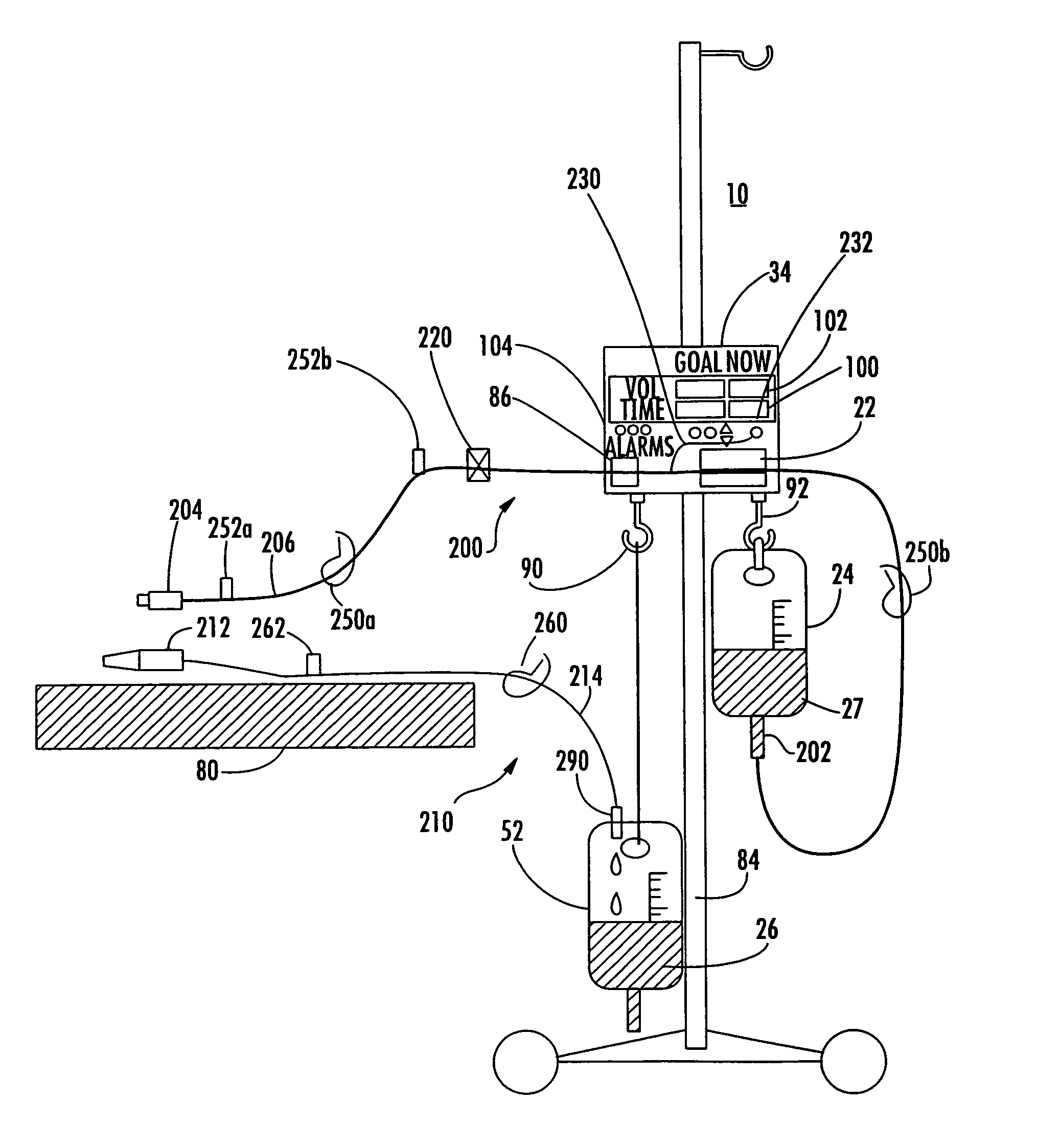 Patient connection system for a balance hydration unit