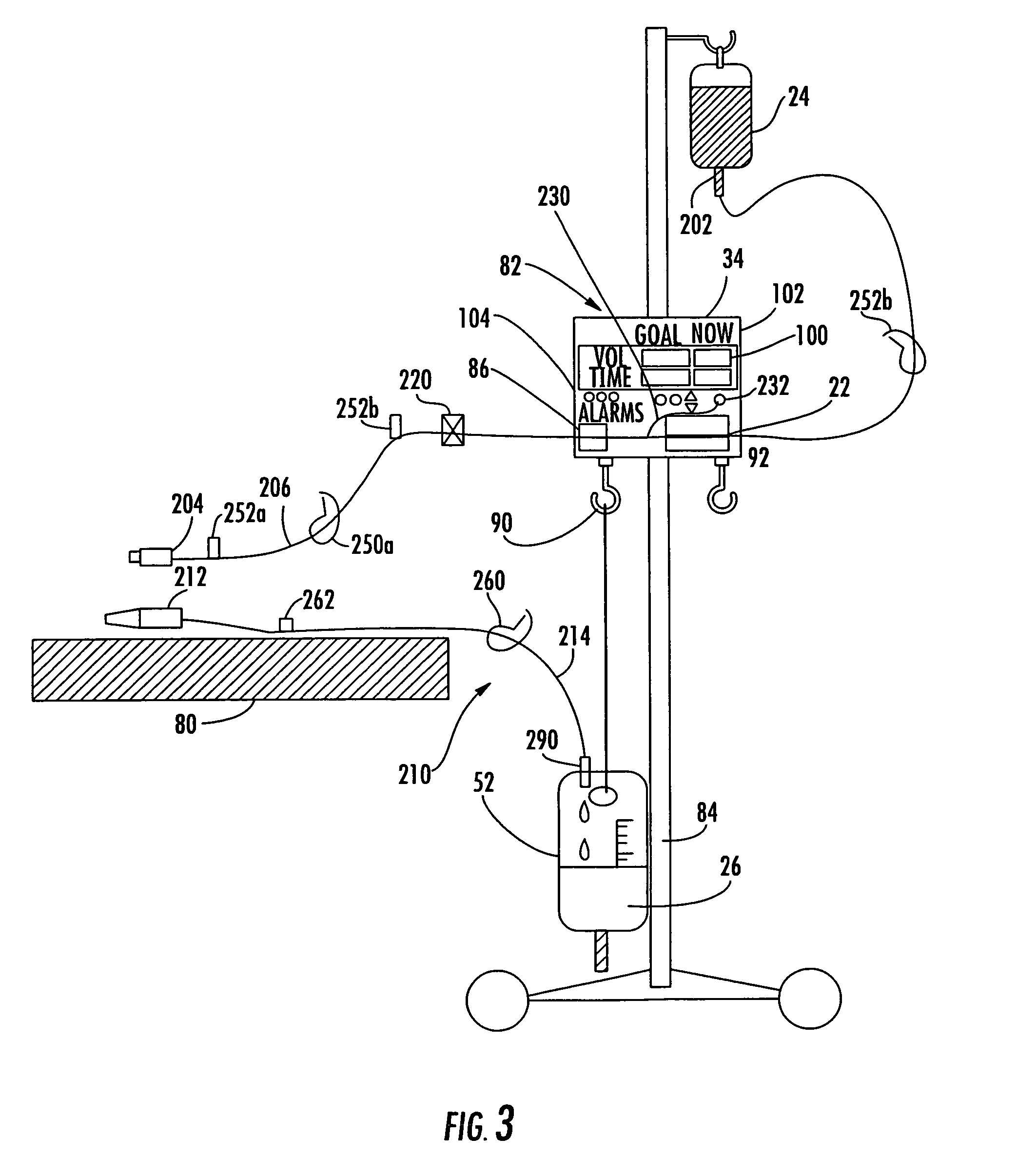 Patient connection system for a balance hydration unit