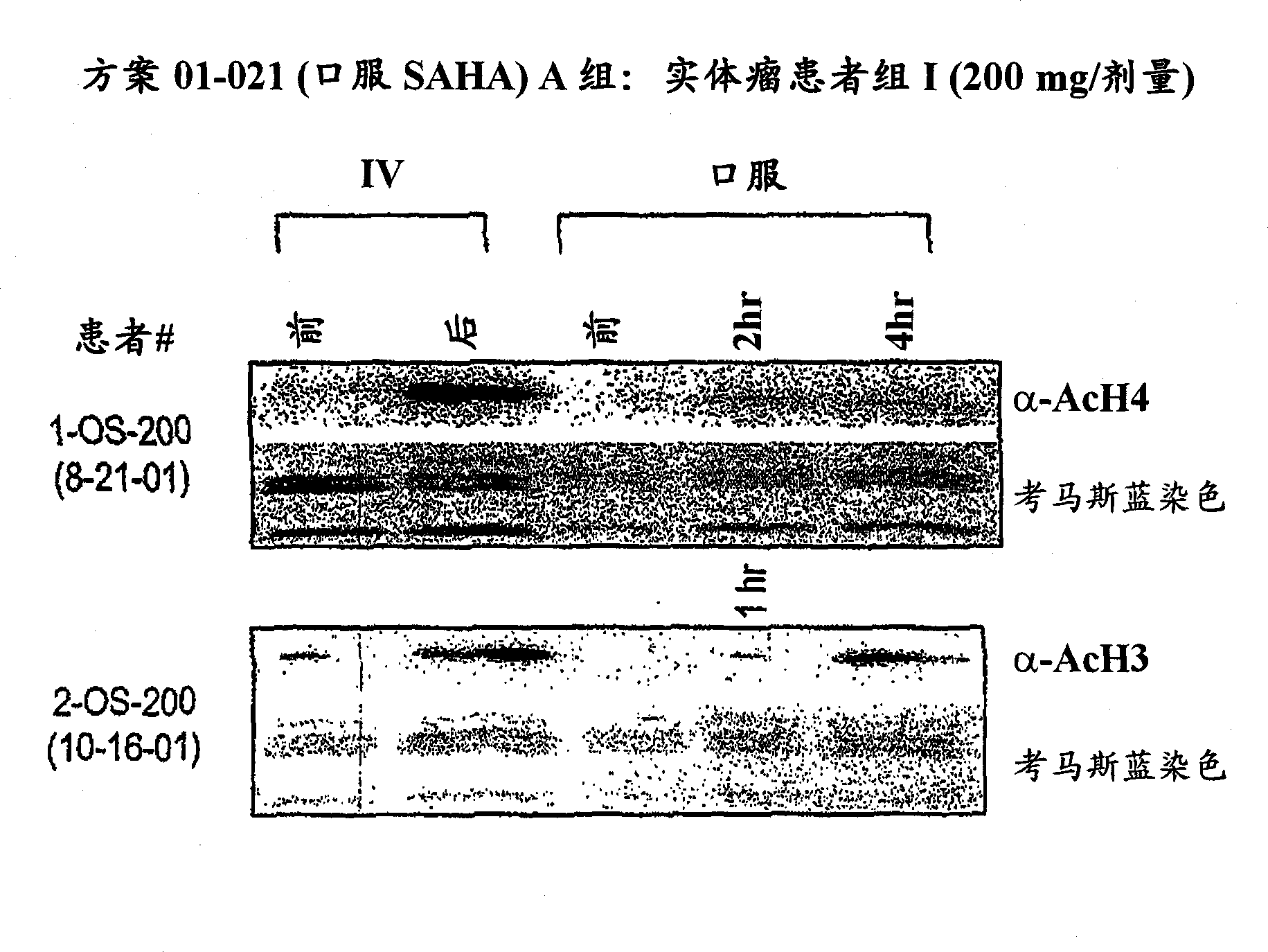 Methods of treating cancer with hdac inhibitors