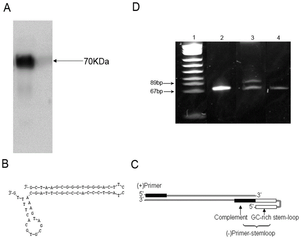 A nucleic acid aptamer specifically binding to β-amyloid precursor protein lyase 1 and its application