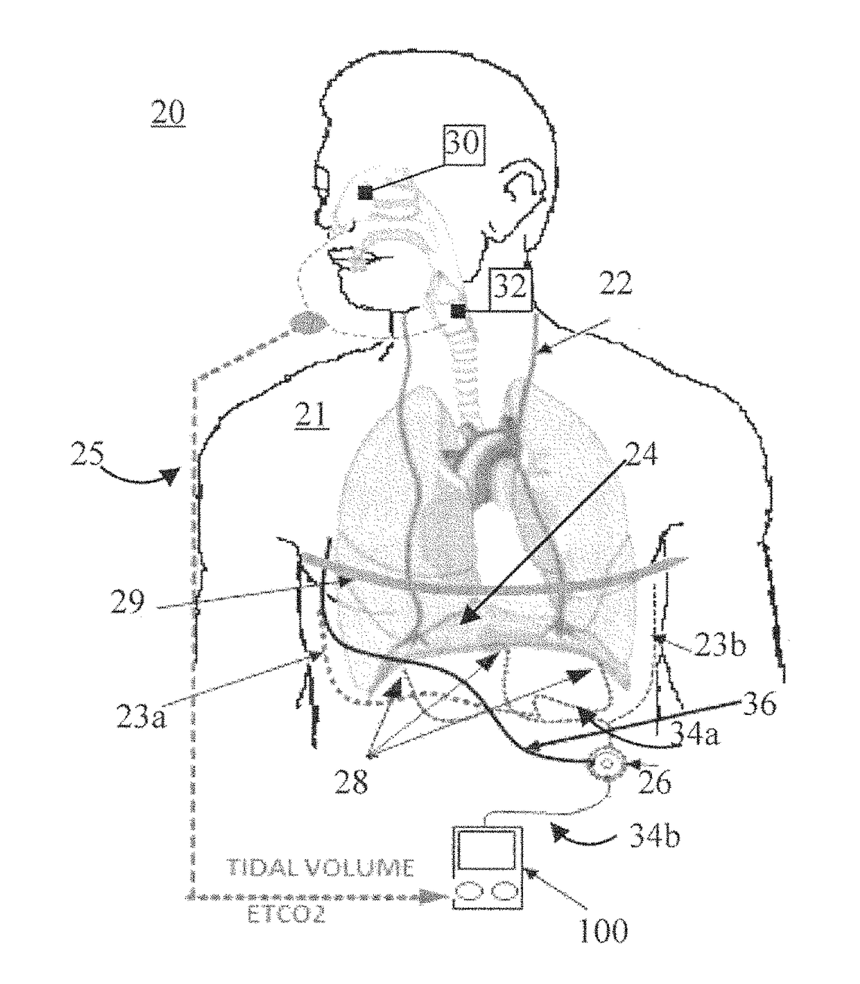 System and method for neuromorphic controlled adaptive pacing of respiratory muscles and nerves