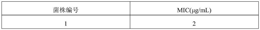 Application of fidaxomicin to preparation of product for inhibiting activity of mycobacterium abscessus