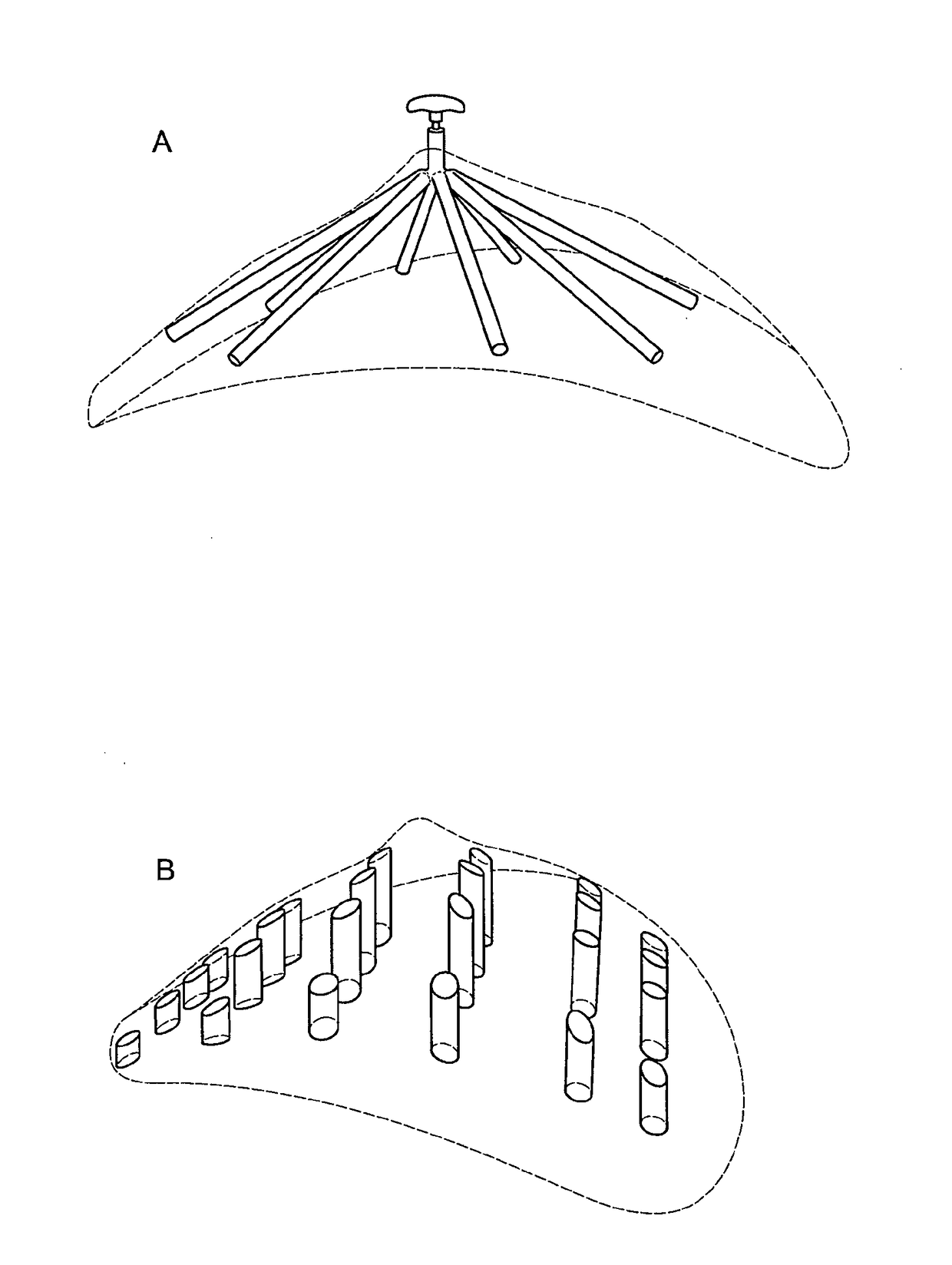 Medical/Surgical Implant