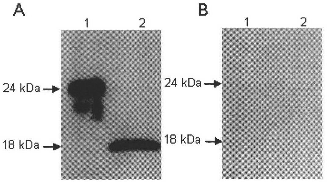 Enzyme-linked immunoassay (ELISA) method of grass carp interleukin 10