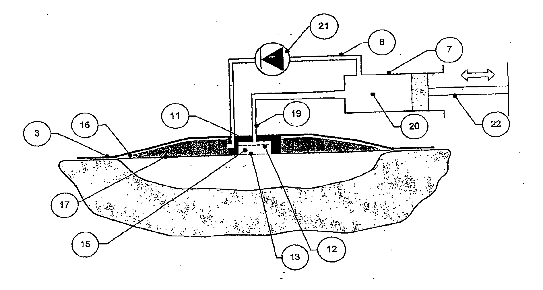 Wound cleansing apparatus in-situ