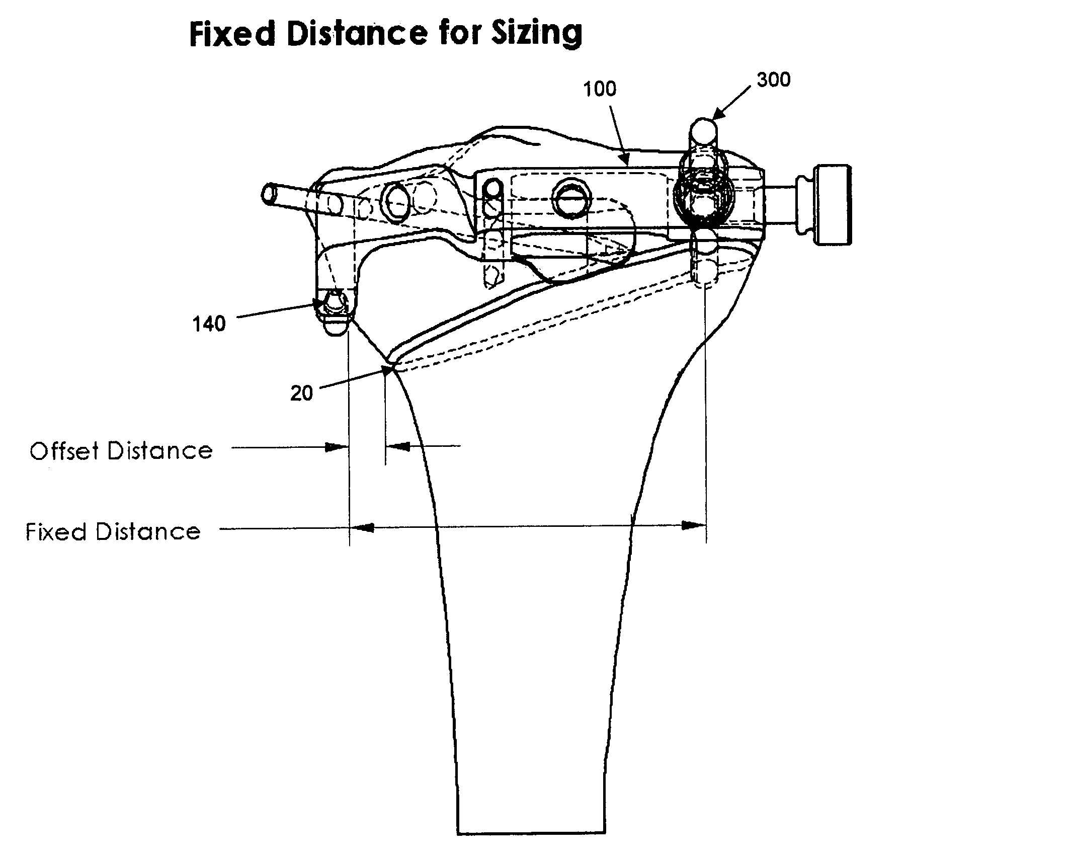 Method and apparatus for performing an open wedge, high tibial osteotomy