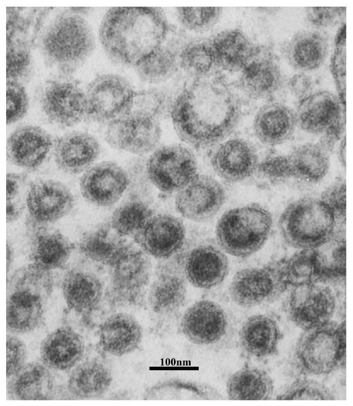 Liposome-encapsulated recombinant veterinary growth-promoting protein as well as preparation method and application of liposome-encapsulated recombinant veterinary growth-promoting protein