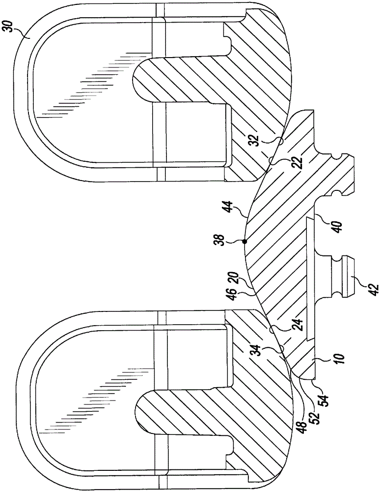 Knee Prosthesis with Identical Patellar Elements of Different Thickness and Top Surface Diameter