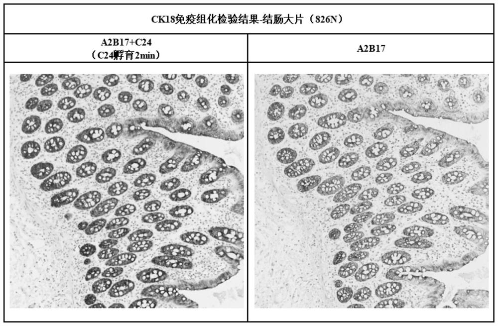 dab chromogenic kit for immunohistochemical detection and its application