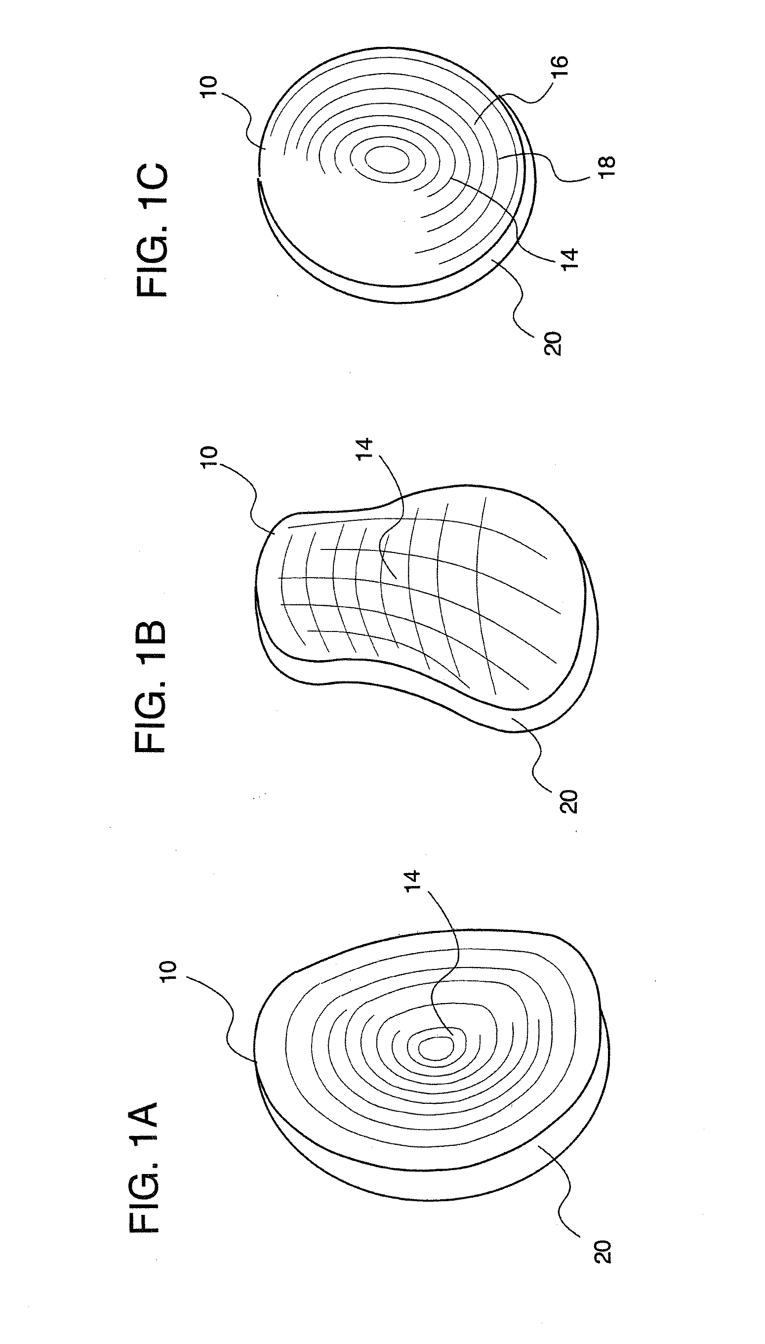 Methods of implanting glenoid inlay