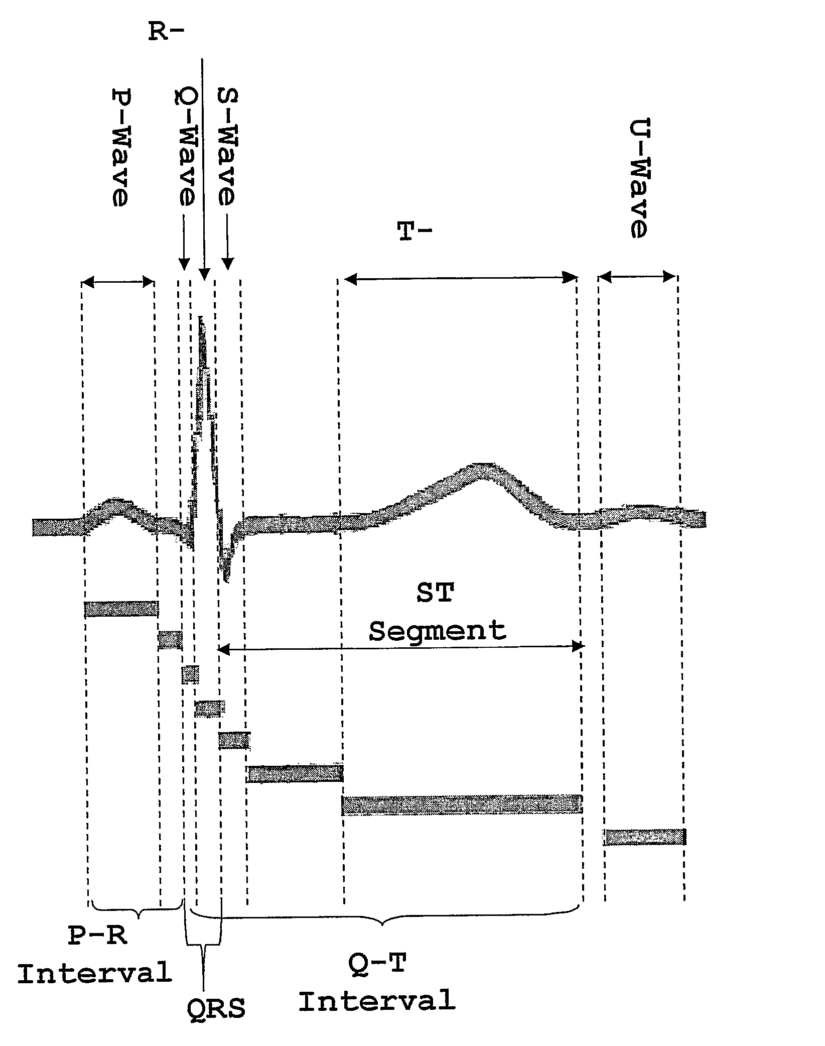 Method and System for Diagnosis of Cardiac Diseases Utilizing Neural Networks