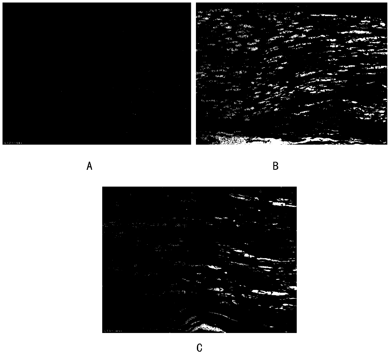 Decellularized nerve scaffold and preparation method thereof