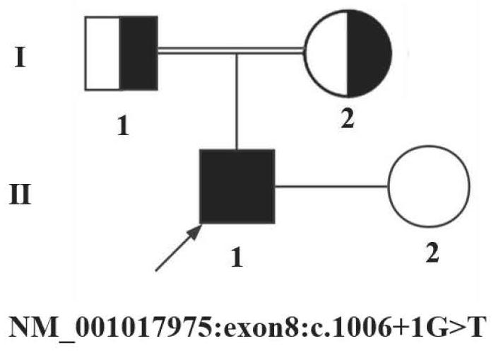 Application of HFM1 gene in preparation of diagnostic kit for detecting non-obstructive azoospermia