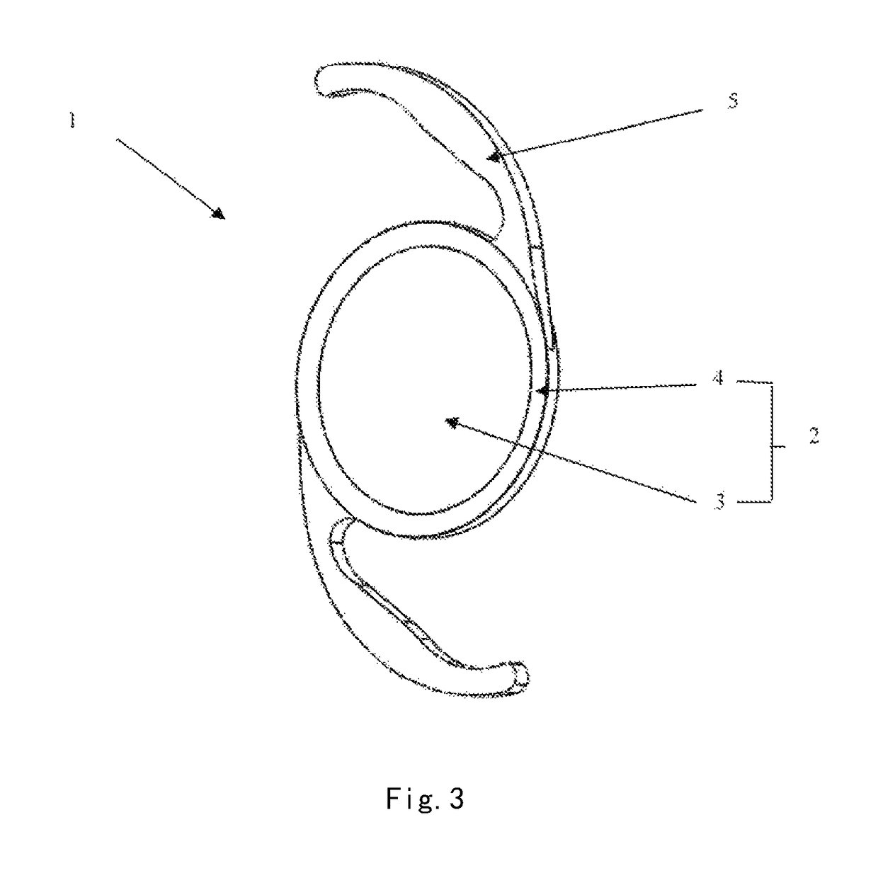 Posterior chamber intraocular lens