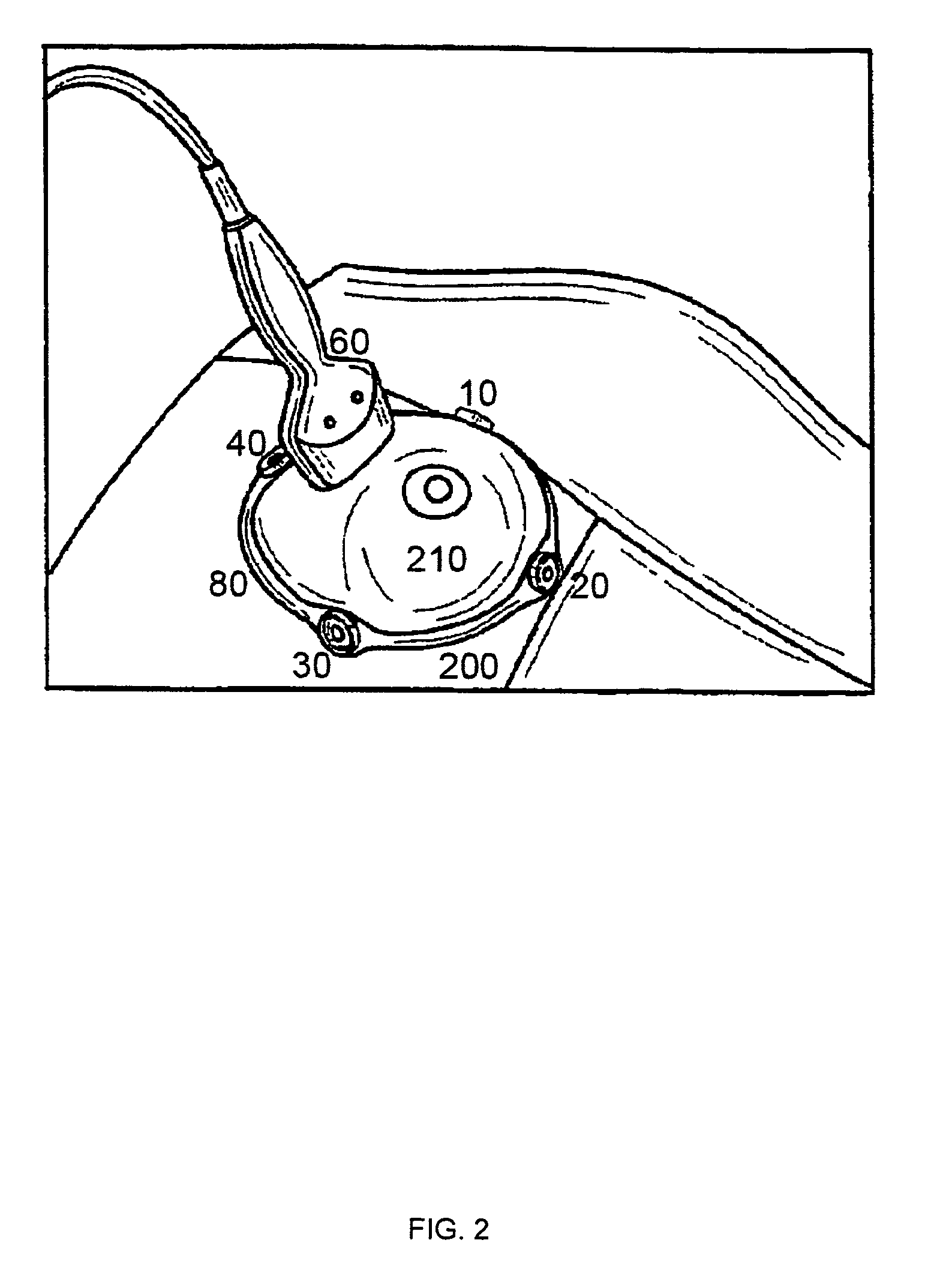 Method of locating the position of a microcalcification in a human breast