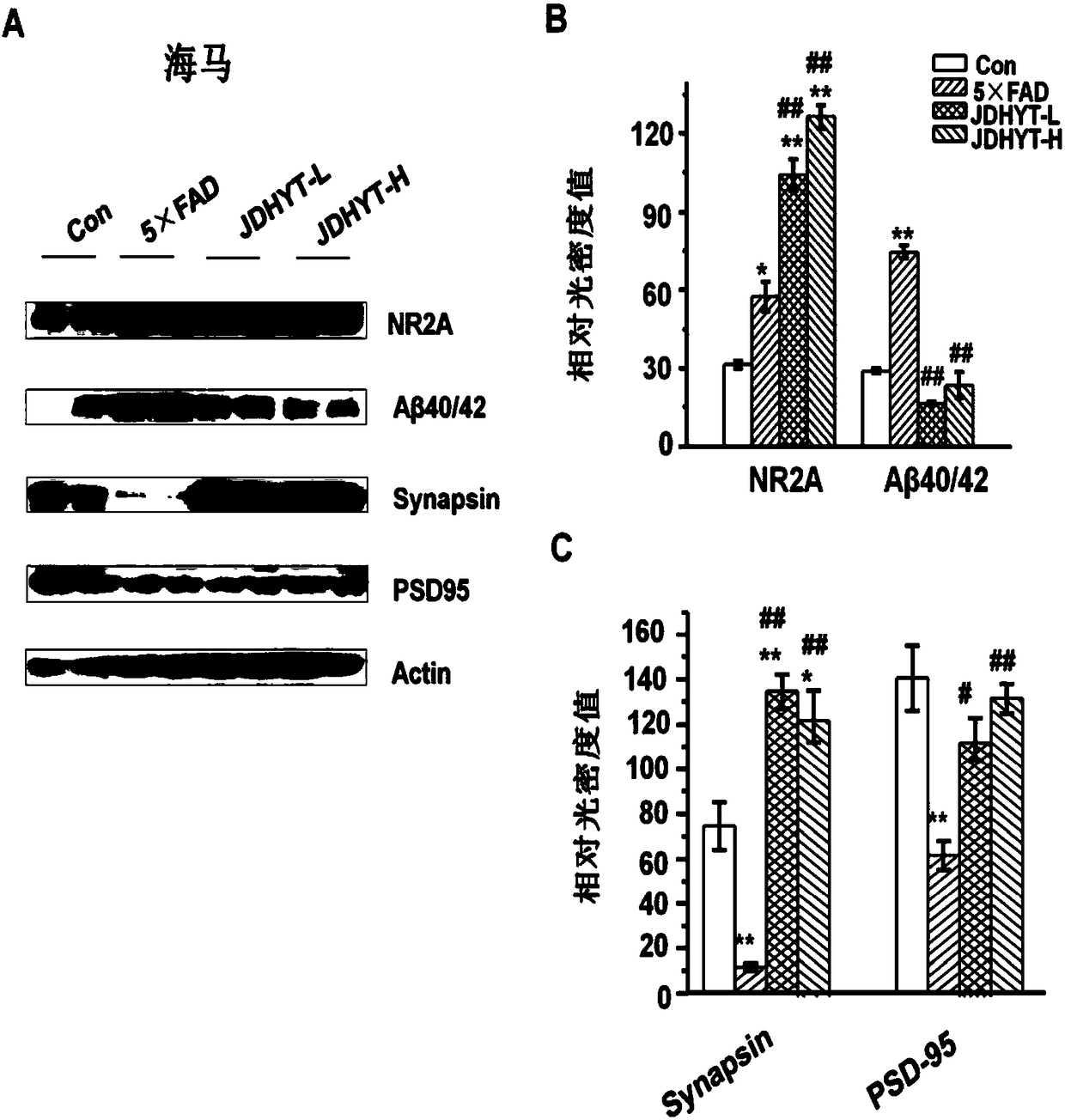 Traditional Chinese medicine composition and preparation method and application thereof