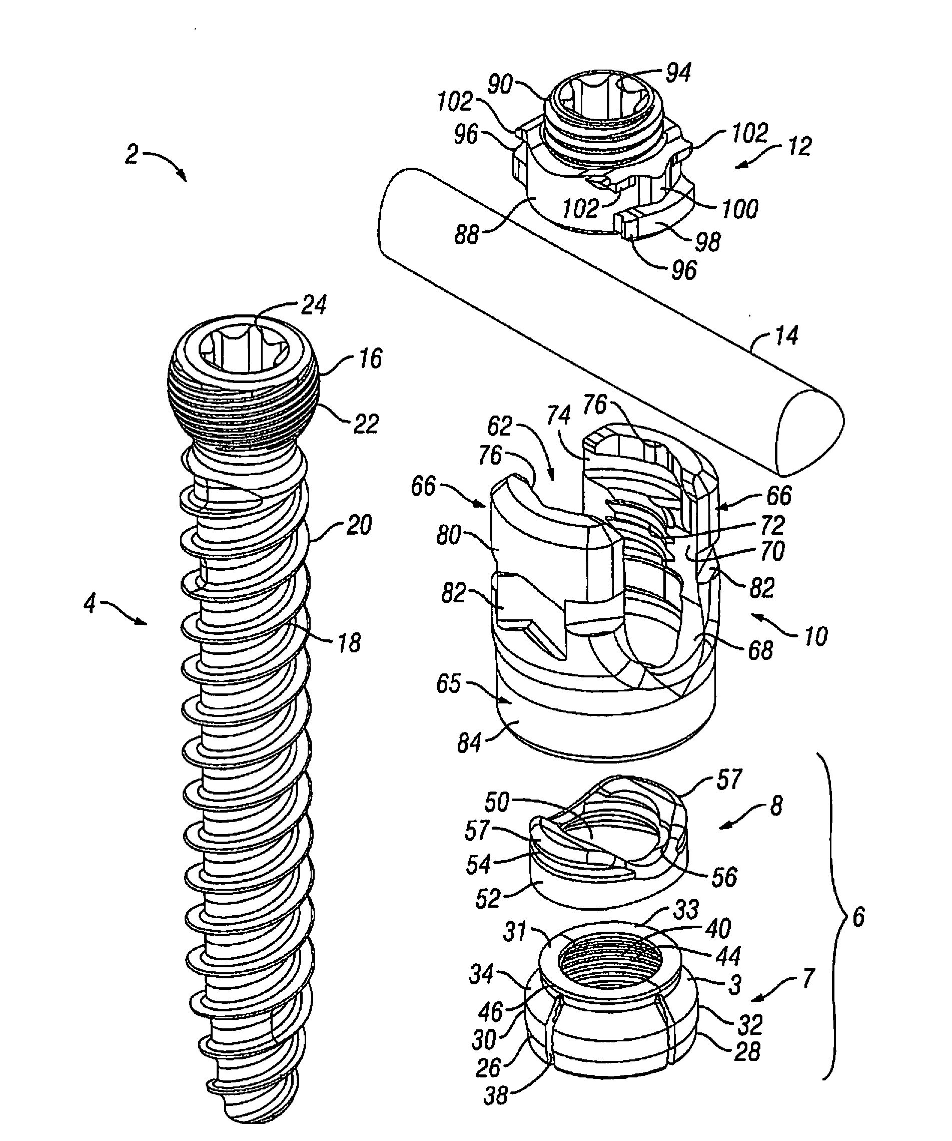 Orthopedic fixation devices and methods of installation thereof