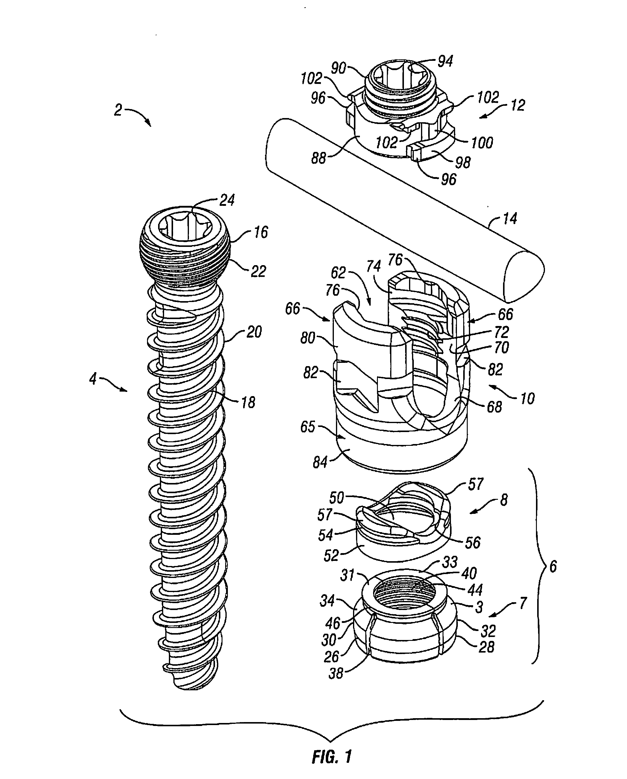 Orthopedic fixation devices and methods of installation thereof