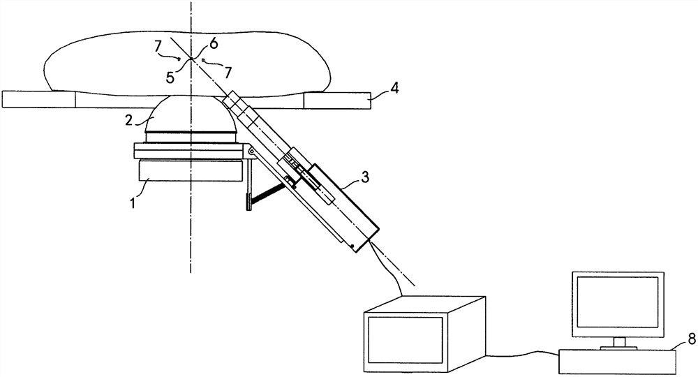 Extracorporeal shock wave lithotripter b method for ultrasonography of target stones