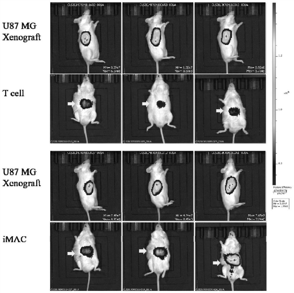 Monocytes and macrophages with solid tumor-directed chemotaxis ability expressing chemokine receptors, and preparation and application thereof