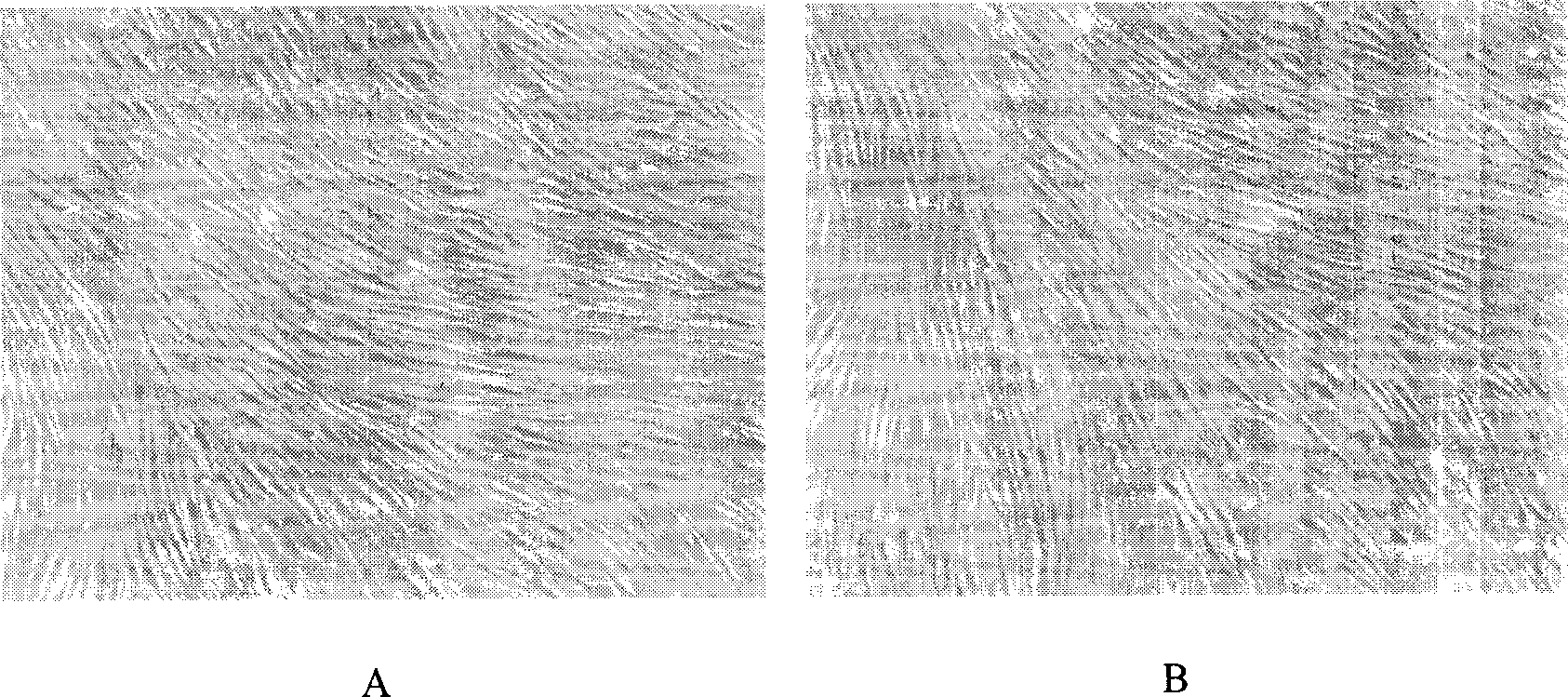 Anti-human marrow mesenchyma stem cell monoclonal antibody ZUC3 and its uses