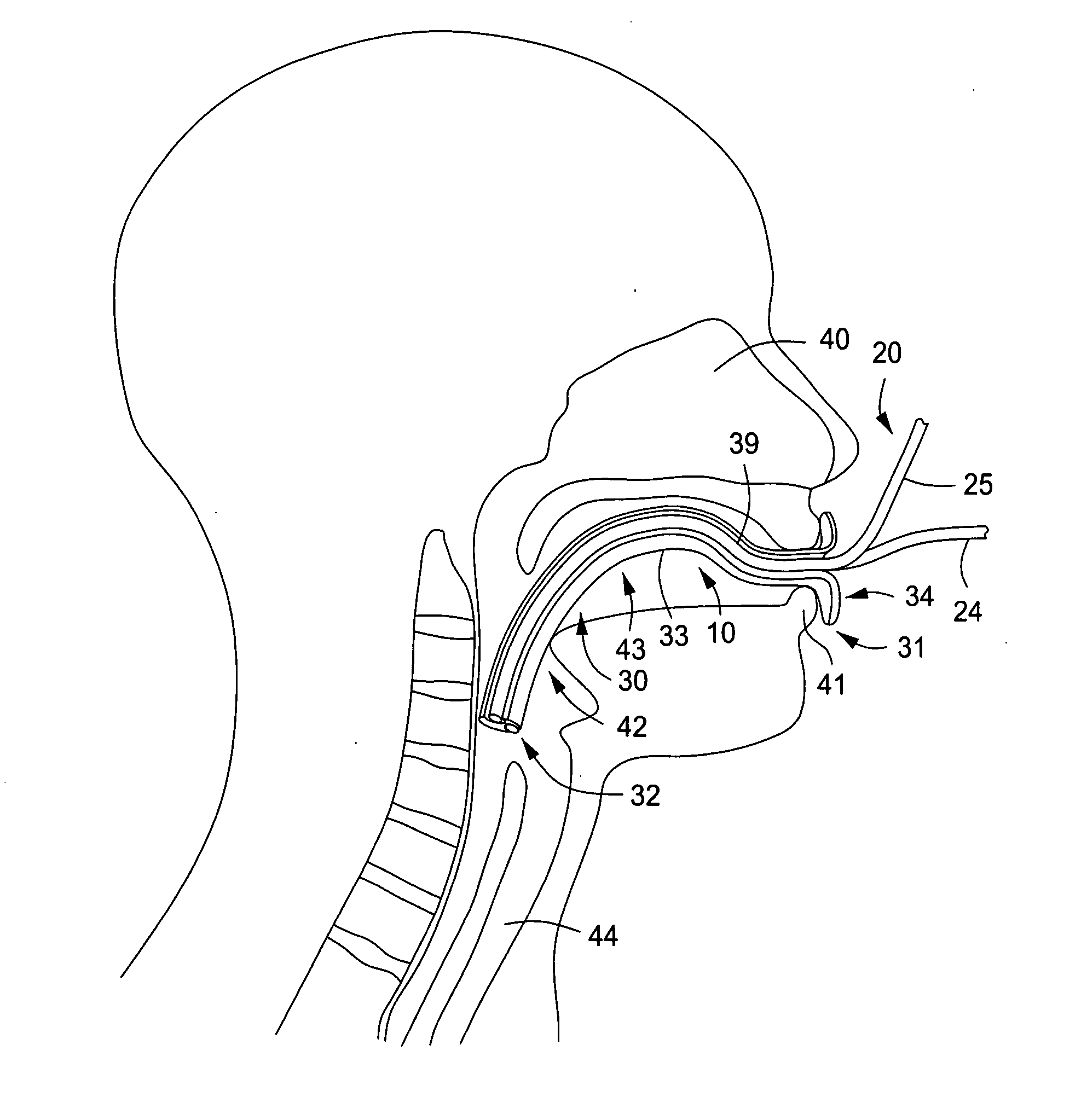 Oral cannula