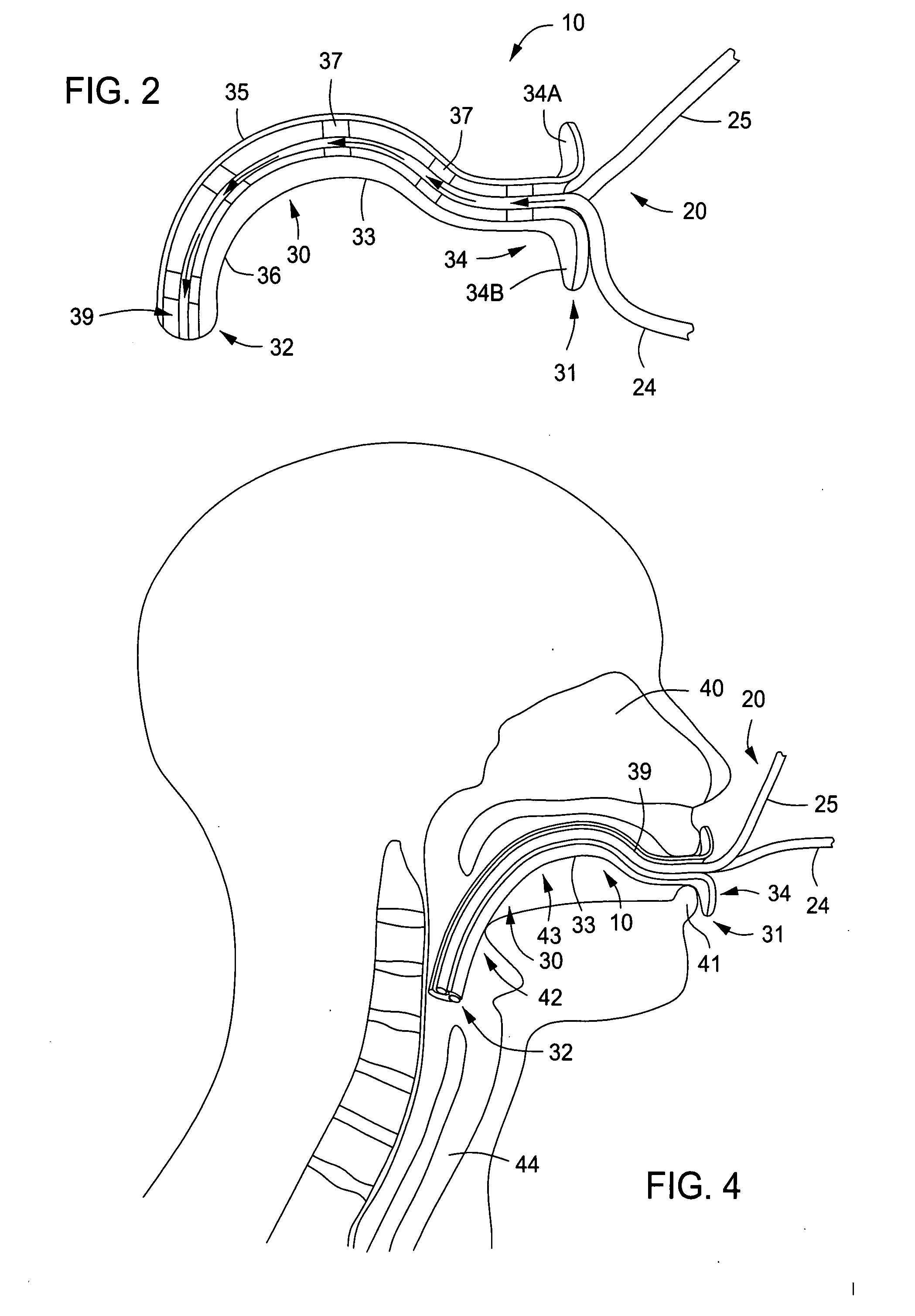 Oral cannula