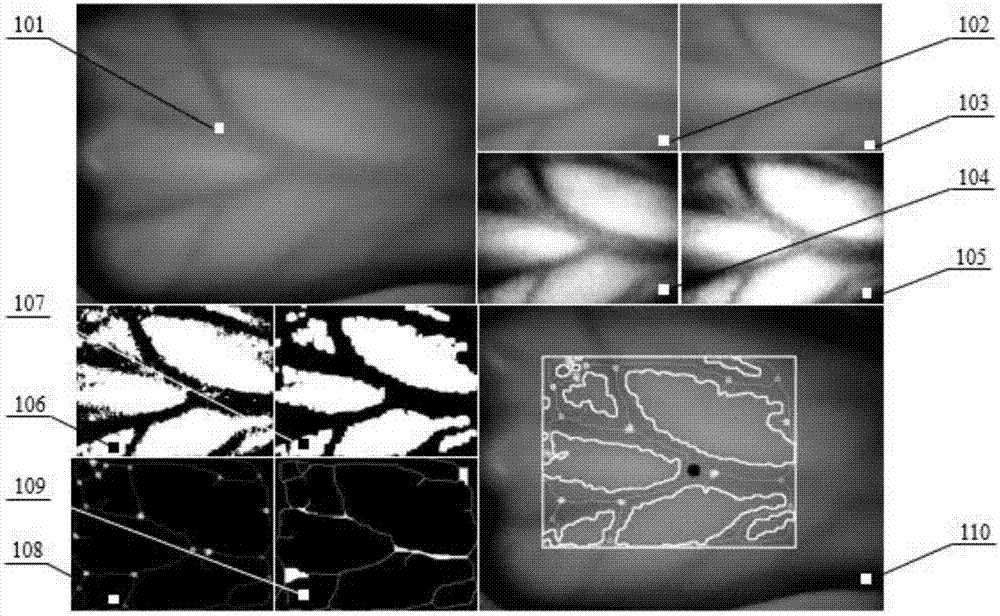 Venous blood sampling needle inserting point automatic extraction method based on vision