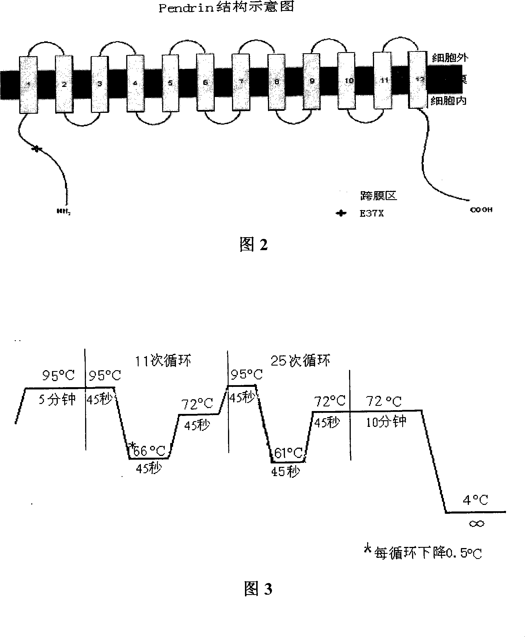 Kit for detecting 227C&gt;T mutation of vestibule water conduit enlargement interrelated gene SLC26A4