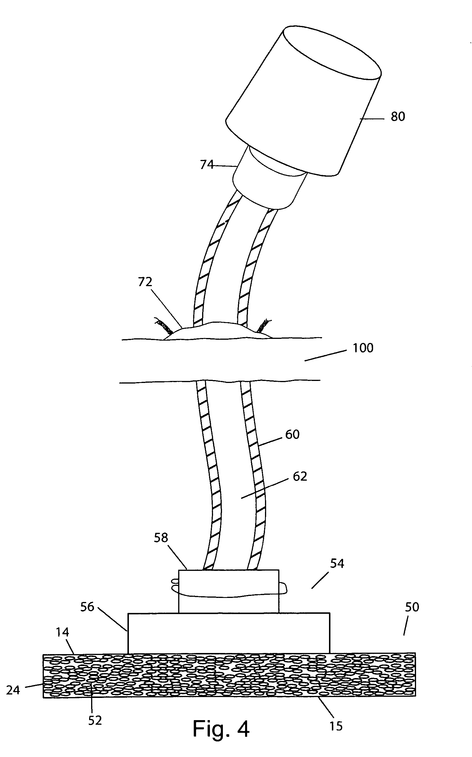 Resorbable polymeric device for localized drug delivery