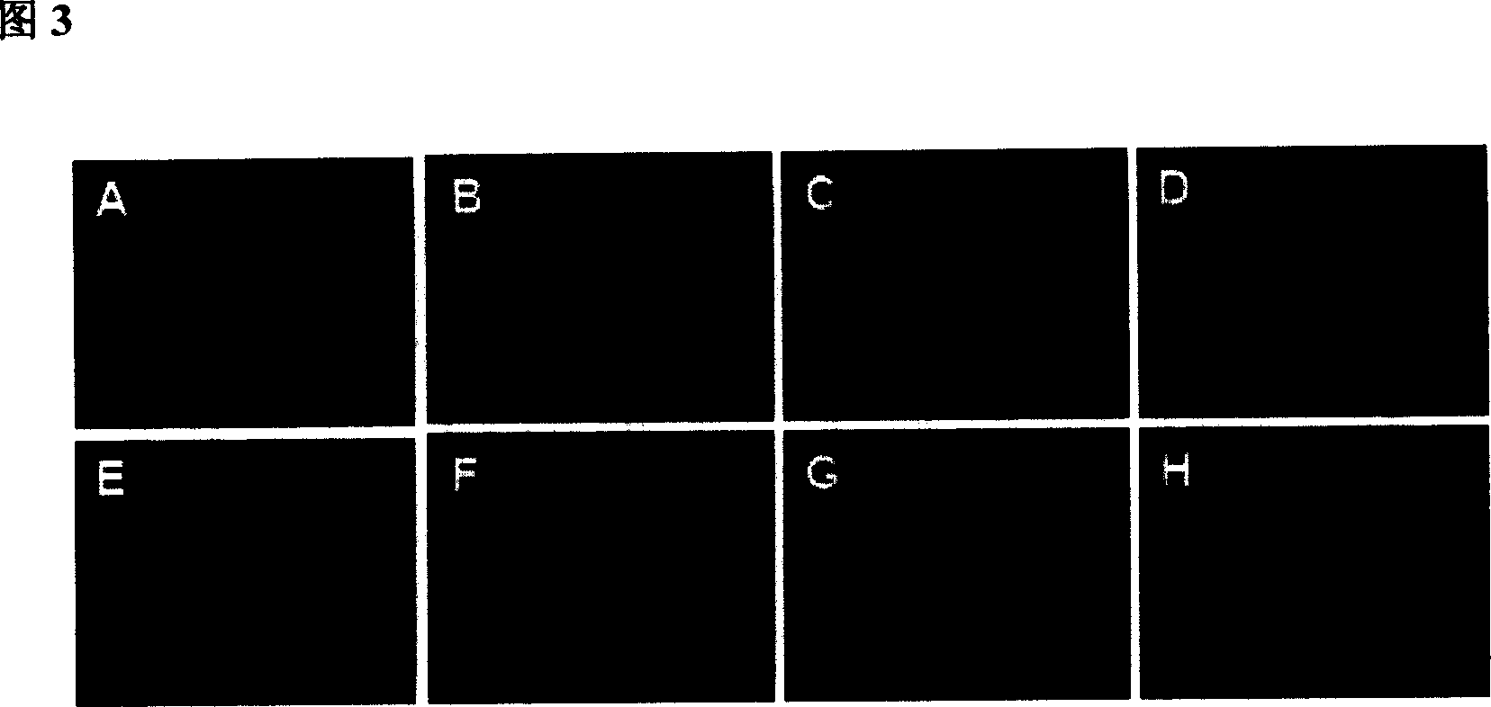 Brain targeting gene transfer and release system and its prepn process