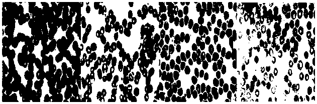 Method for synthesizing chalcone derivative with anti-malaria activity