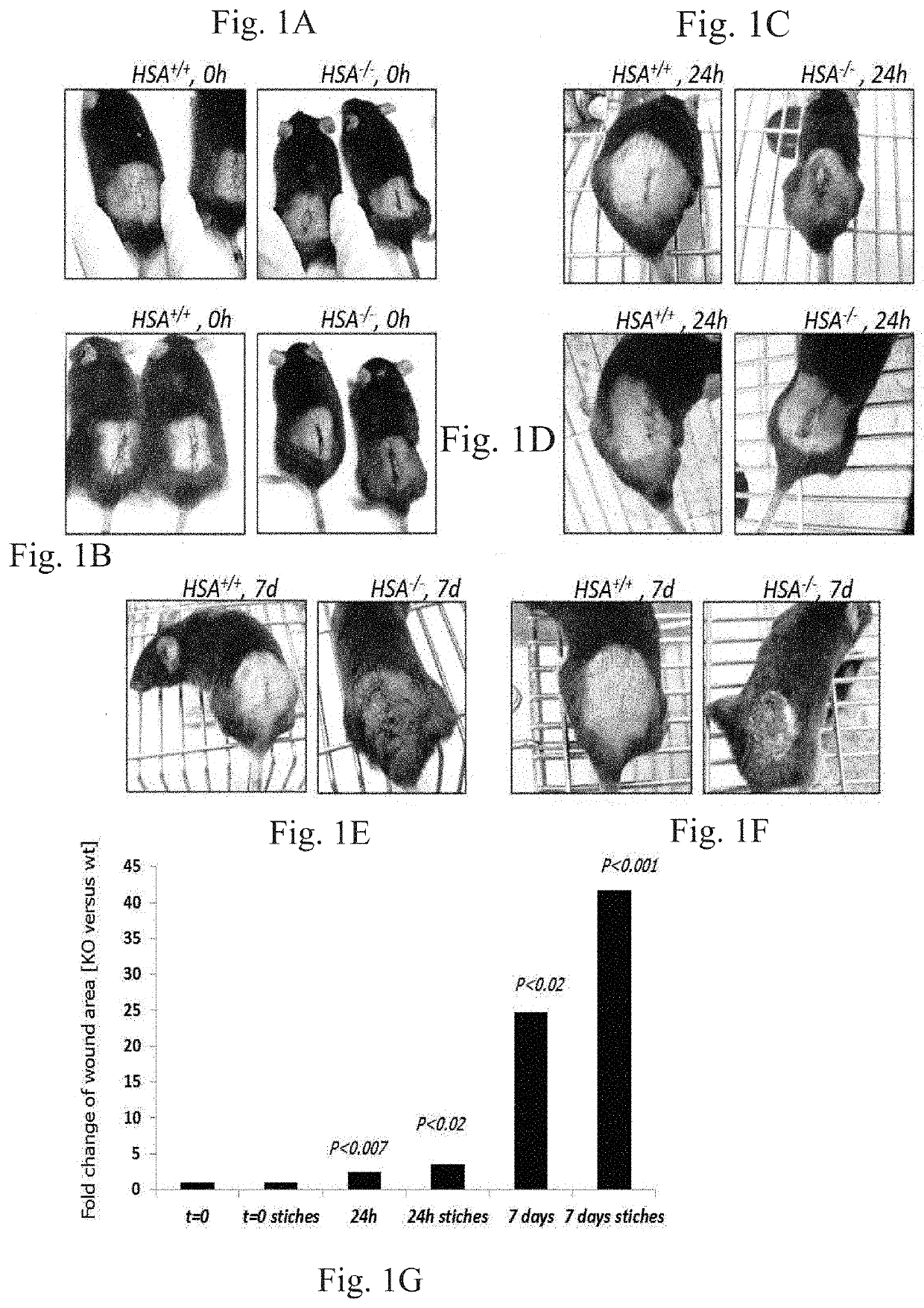 Methods and pharmaceutical compositions for improving wound healing using CD24