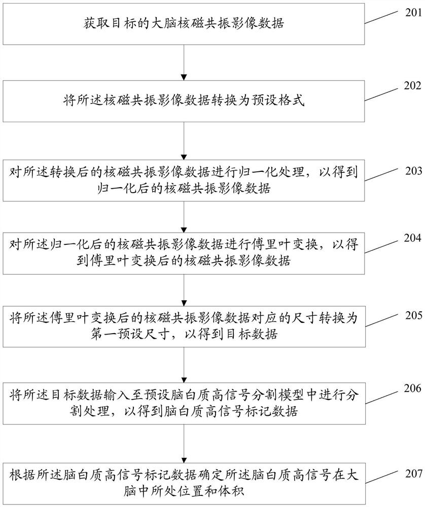 White matter high signal segmentation method, device and equipment and storage medium