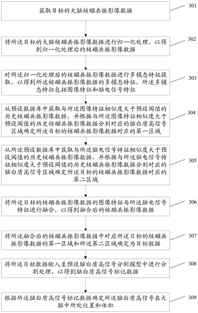 White matter high signal segmentation method, device and equipment and storage medium