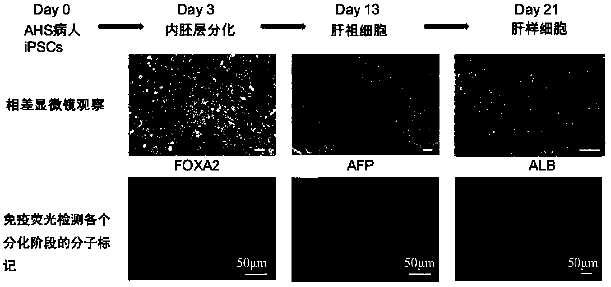 Pharmaceutical composition for the treatment of alpers-huttenlocher syndrome