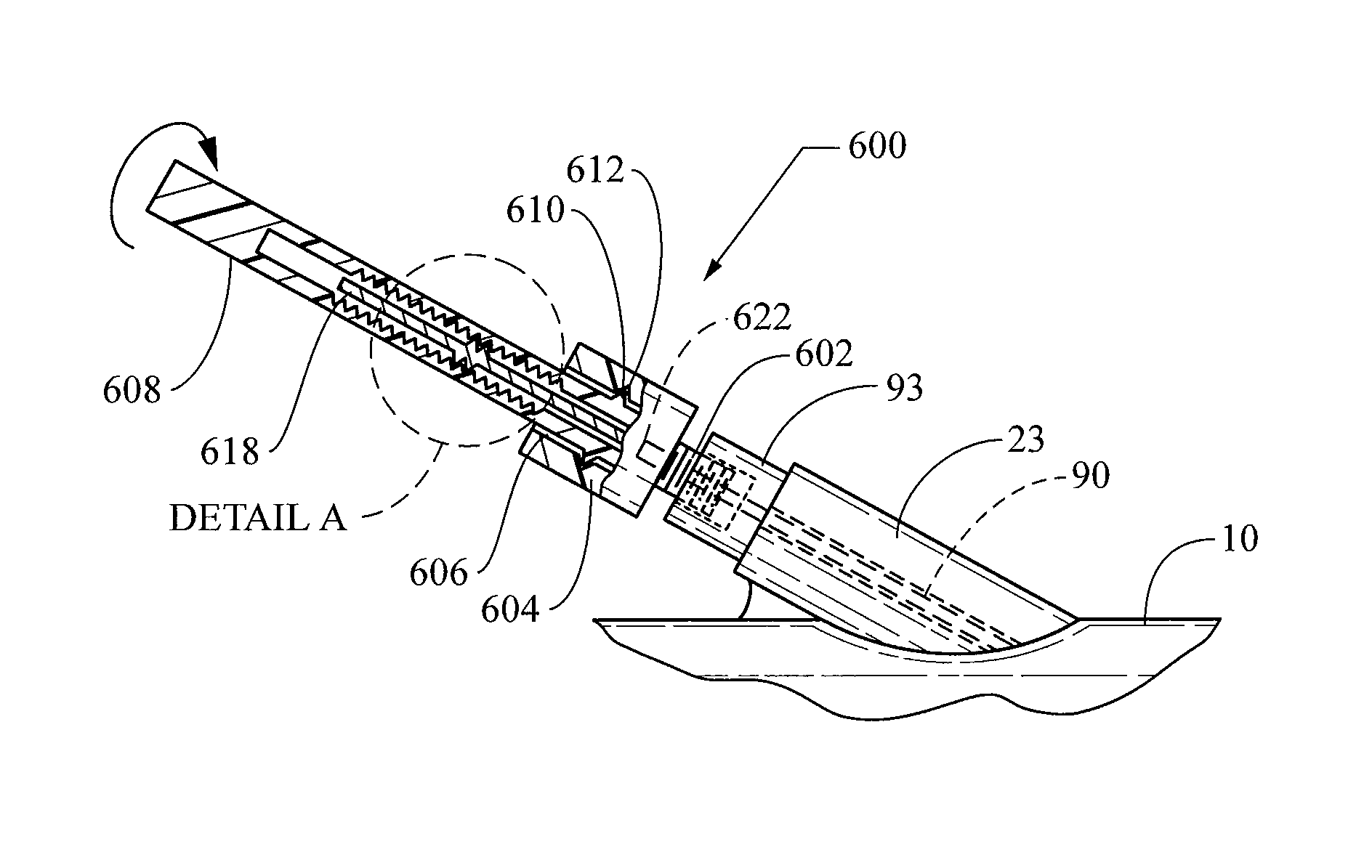 Distal wire stop having adjustable handle