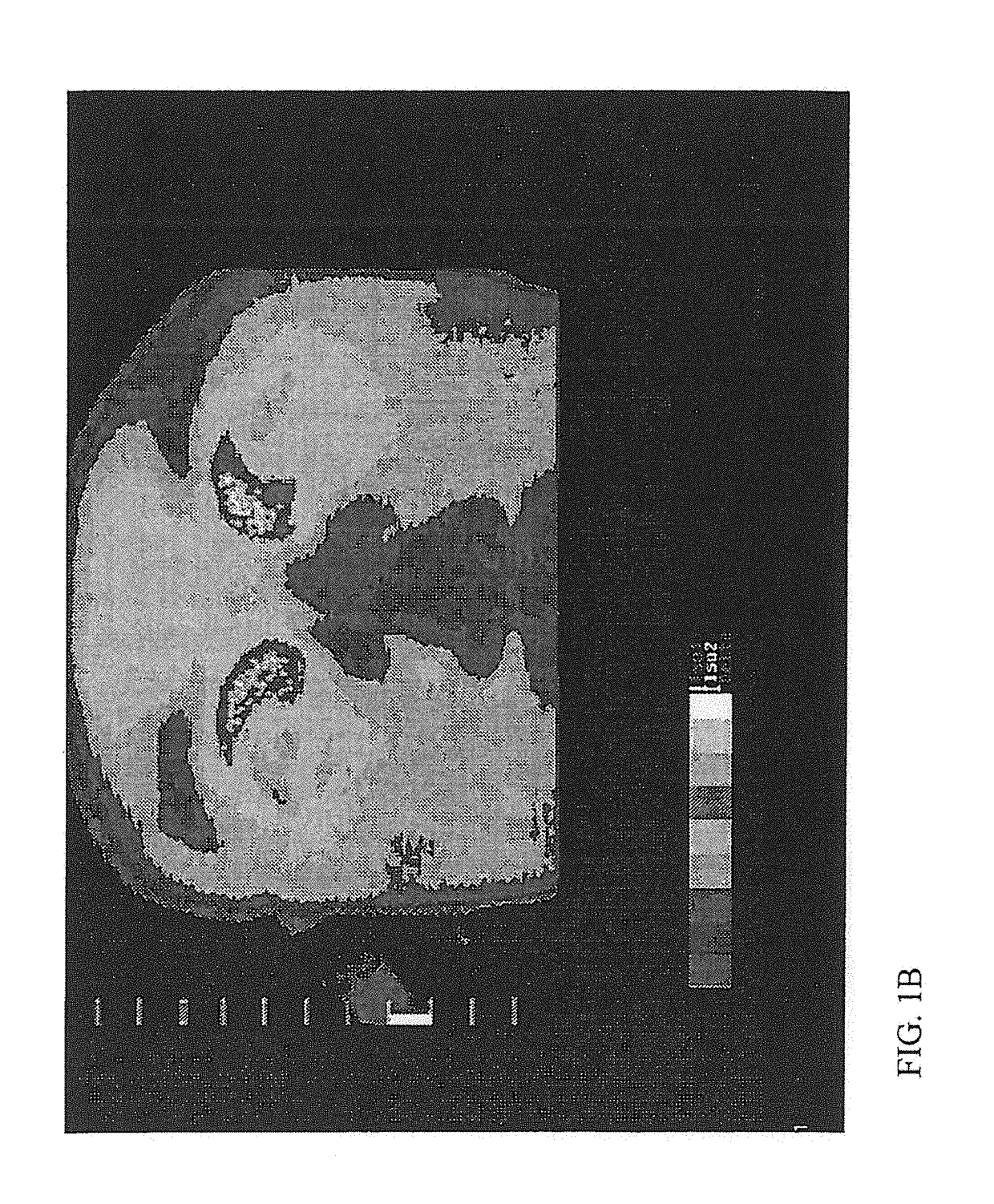 Apparatus and method for measuring biologic parameters