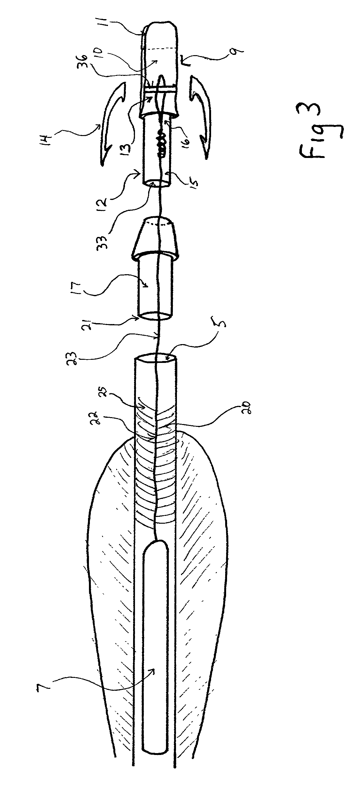 Device for detaching locator from arrow for tracking game