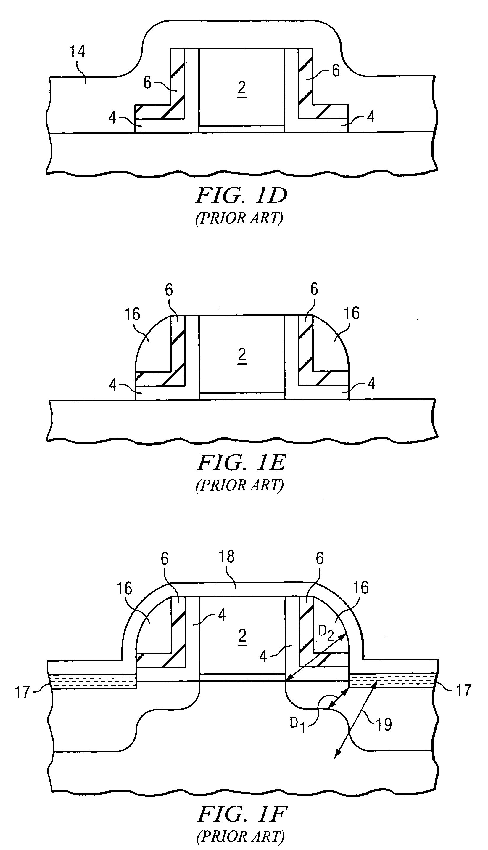 MOS devices with corner spacers