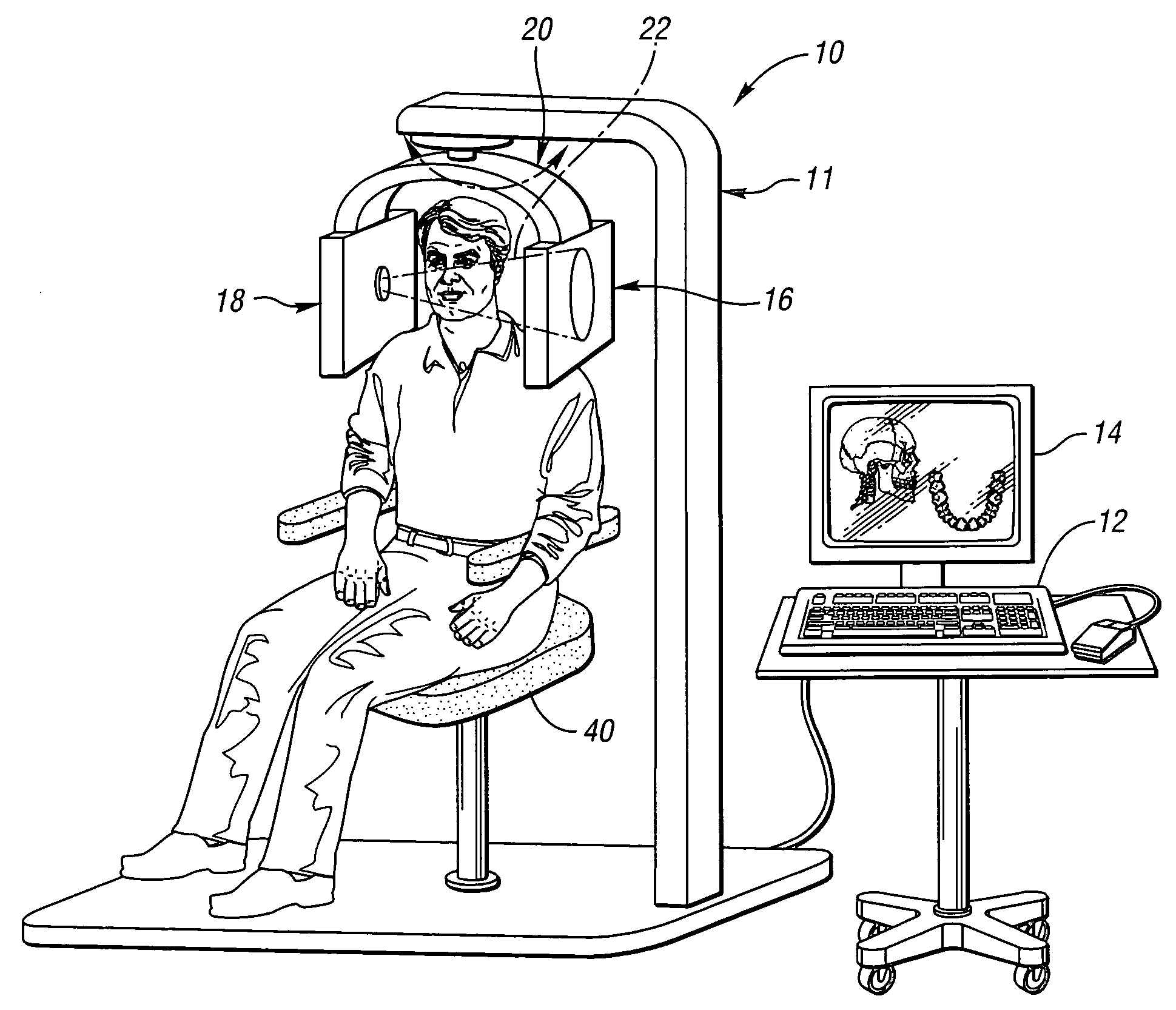 High spatial resolution X-ray computed tomography (CT) method and system